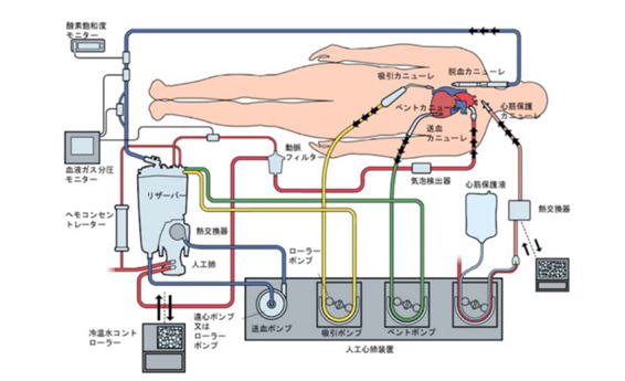 体外循環業務